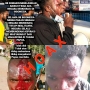 Kapolresta Jayapura Tegaskan Beredarnya Foto Pendemo Terluka di Medsos Hoax