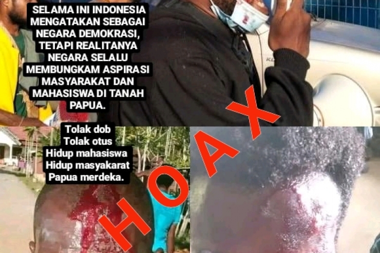 Kapolresta Jayapura Tegaskan Beredarnya Foto Pendemo Terluka di Medsos Hoax