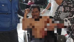 Di Puncak Jaya, OTK Bacok Tukang Ojek Hingga Terluka Parah 