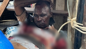 Satu Warga Meninggal Dunia dan Empat Lainnya Luka Akibat Penembakan KKB di Kali Semen Nabire
